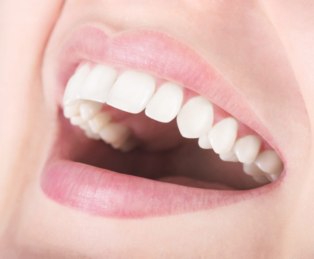 londonderry dental implants