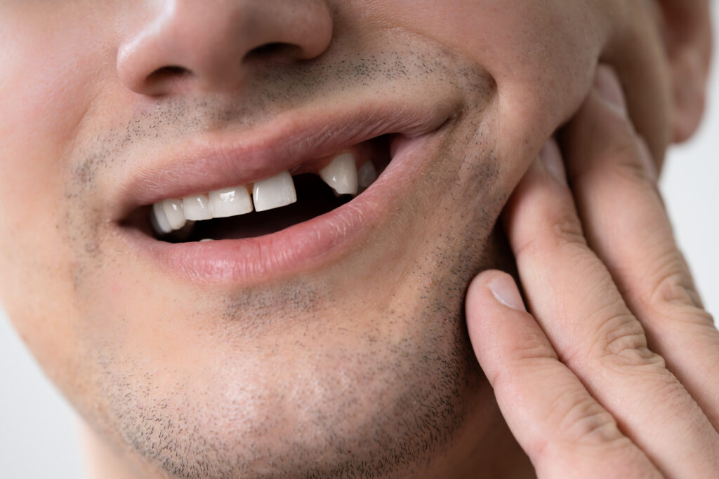 londonderry traumatic dental injuries